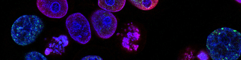 cells viewed through microscope