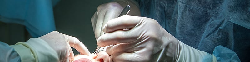 Eye Surgery